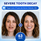 Fast-Dissolving Tooth & Gum Care Oral Strips – Daily Oral Wellness Support