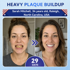 Fast-Dissolving Tooth & Gum Care Oral Strips – Daily Oral Wellness Support