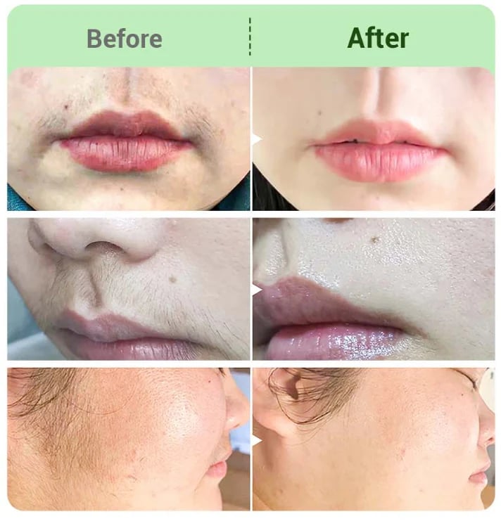 Hair Removal Cream for Women & Men – Gentle Depilatory Cream for Smooth-Looking Skin