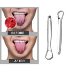 2-Pack: Stainless Steel Tongue Cleaner Scraper