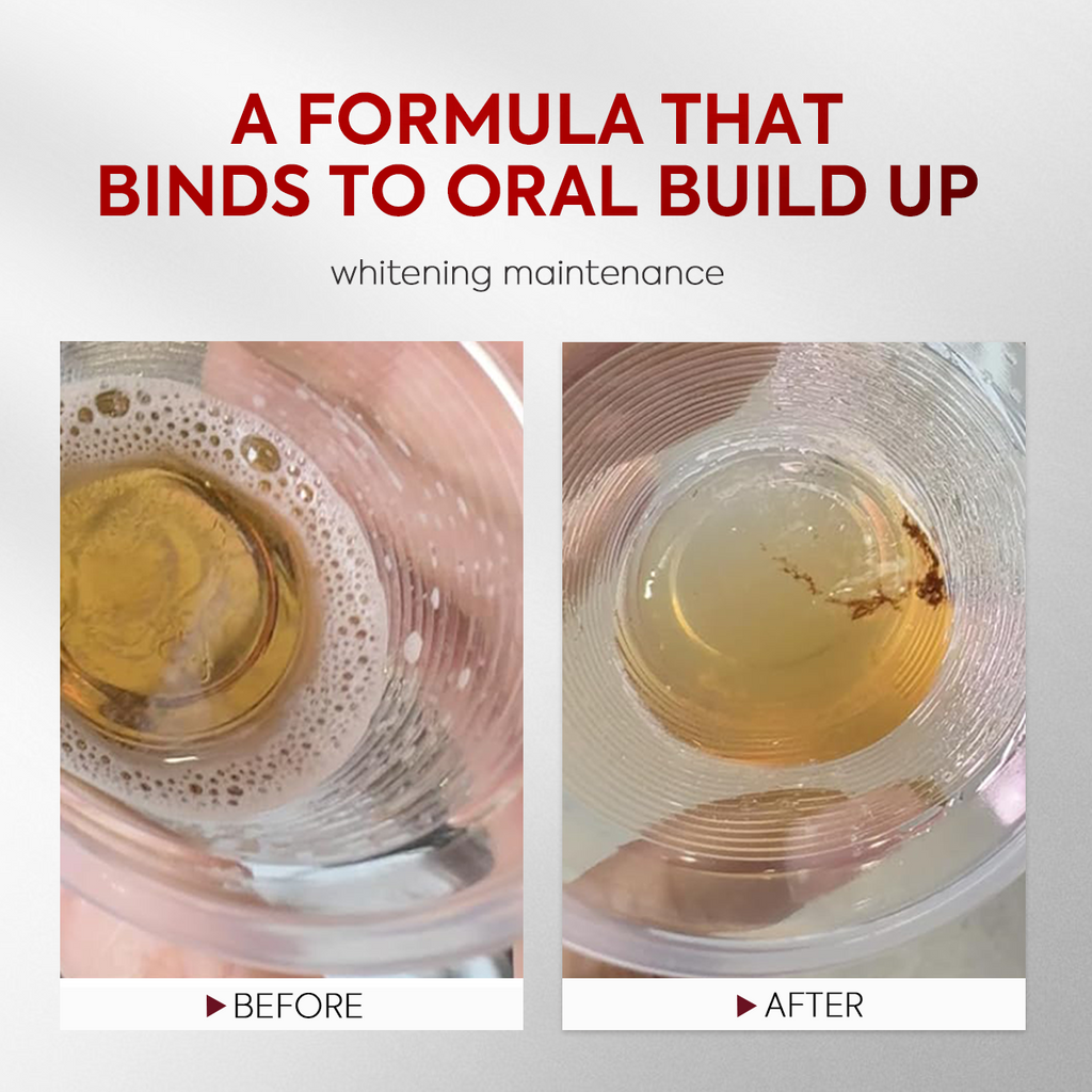 Stain-Lifting Whitening Mouthwash for Debris Removal & Fresh Breath