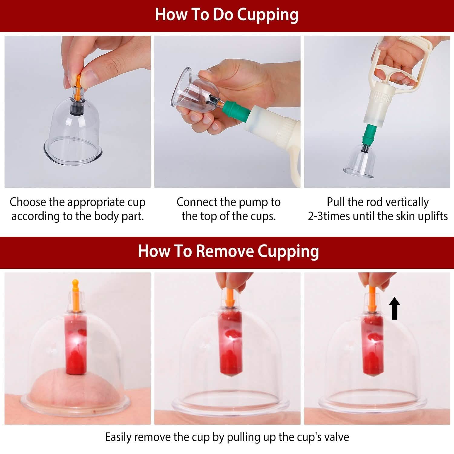 32 Cups Chinese Therapy Set