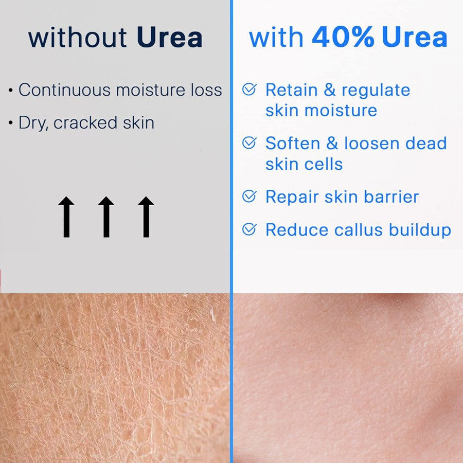 40% Urea Repair Cream