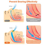 4-Pieces: Magnetic Nose Clip Anti Snoring Device