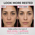 Under-Eye Red Light Beauty Device – Gentle LED Eye Care for Tired-Looking Eyes