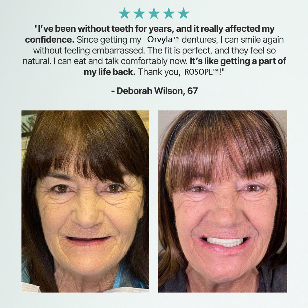 ORVYLA DENTURES-Boil-and-Bite Functional Denture, Self-fit at Home, Fully Adjustable for Narrow or Wide Arches, Long or Short-term Solution, Eat, Drink and Smile Confidently