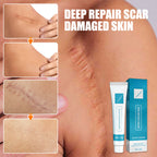Scar Repair Cream