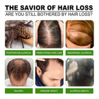 Hair Growth Support System – Scalp Care Kit for Thicker, Fuller-Looking Hair