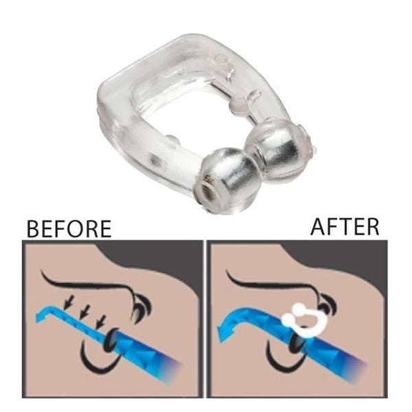 Anti Snore Device