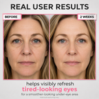 Under-Eye Red Light Beauty Device – Gentle LED Eye Care for Tired-Looking Eyes