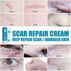 Scar Repair Cream