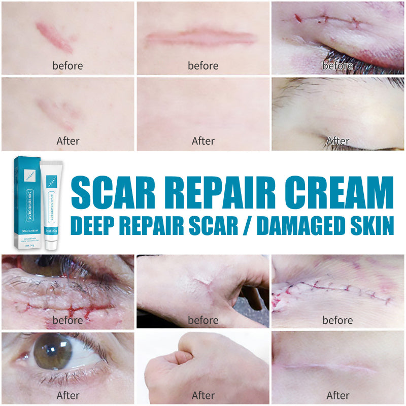 Scar Repair Cream (50% OFF)