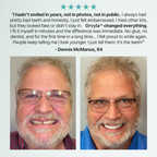 ORVYLA DENTURES-Boil-and-Bite Functional Denture, Self-fit at Home, Fully Adjustable for Narrow or Wide Arches, Long or Short-term Solution, Eat, Drink and Smile Confidently