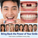 Medical Full Denture with Strong Suctiond Custom-Fit Full Functional Dentures