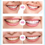 Dental Whitening Pen