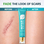 Scar Repair Cream
