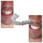 Dental coverage for a perfect smile - comfortable aligners