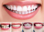 Invisible Dental Realignment Tray