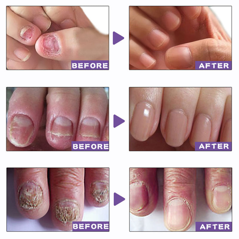Nail Care Gel (40% off)