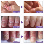 Nail Care Gel (40% off)