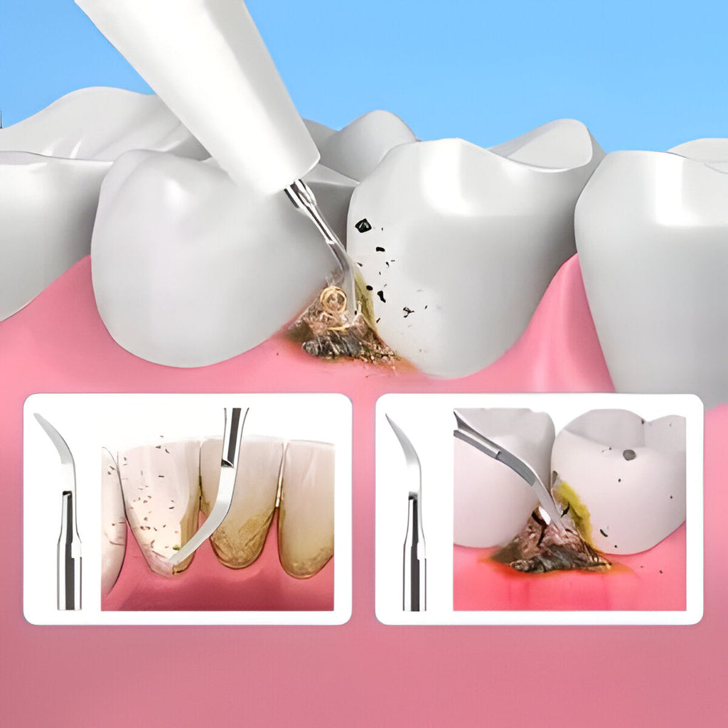 Ultrasonic scaler