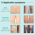 Varicose Deep Nourishing Soothing Vein Cream