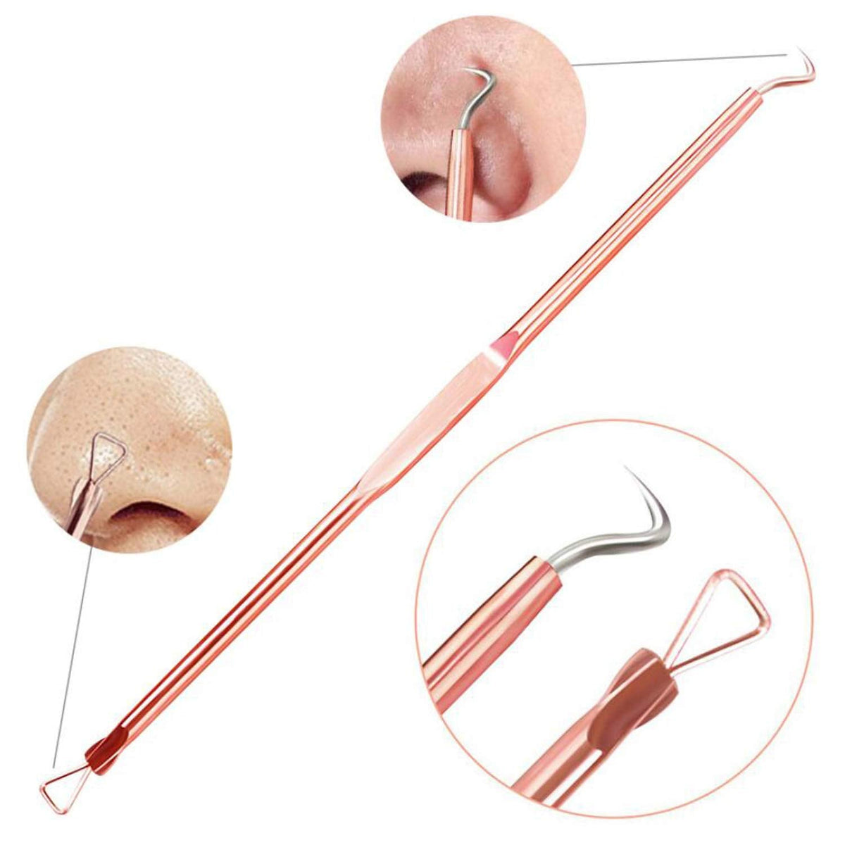 Pimple & Blackhead Remover Tool Kit
