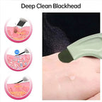 Blackhead Remover Tool Extractor
