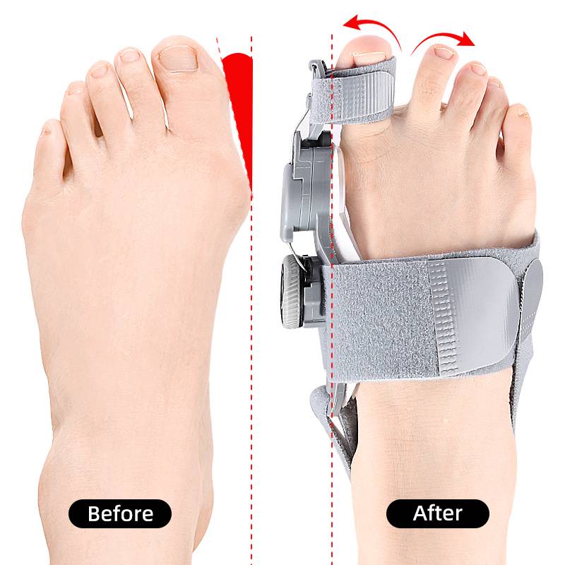 Natural Bunions Corrector Toe Spacer