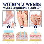 Cracked Foot Heel Treatment 3 Pack