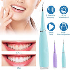 Electric Tartar Remover For Teeth