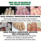 Ginger Nail Care Liquid Onychomycosis Fungus Repair Hand and Foot Nail Care