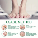 Ginger Nail Care Liquid Onychomycosis Fungus Repair Hand and Foot Nail Care