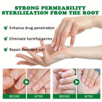 Ginger Nail Care Liquid Onychomycosis Fungus Repair Hand and Foot Nail Care