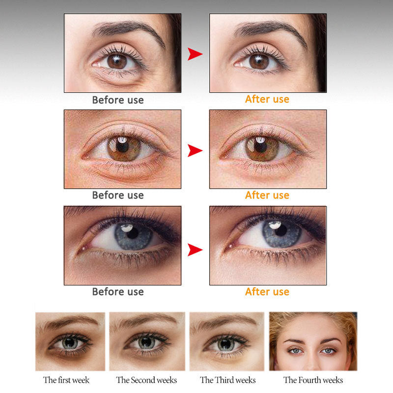 GlowRevive Anti-Aging Eye Serum