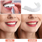 Veneers for Teeth with Natural White Finish