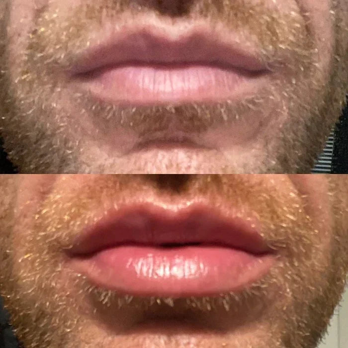 LumaGlow Instant Lip Plumper Serum for Fuller Lips Now