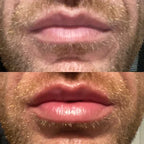 LumaGlow Instant Lip Plumper Serum for Fuller Lips Now
