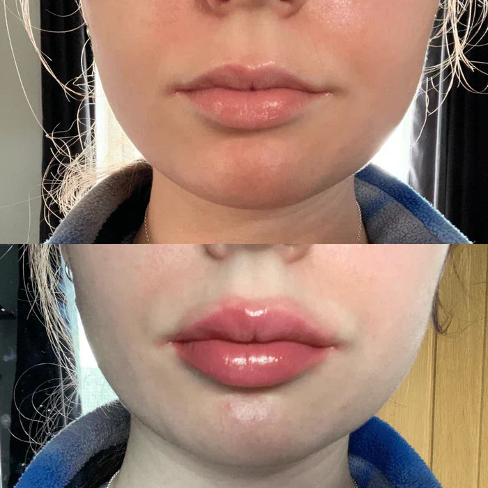 LumaGlow Instant Lip Plumper Serum for Fuller Lips Now