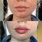 LumaGlow Instant Lip Plumper Serum for Fuller Lips Now