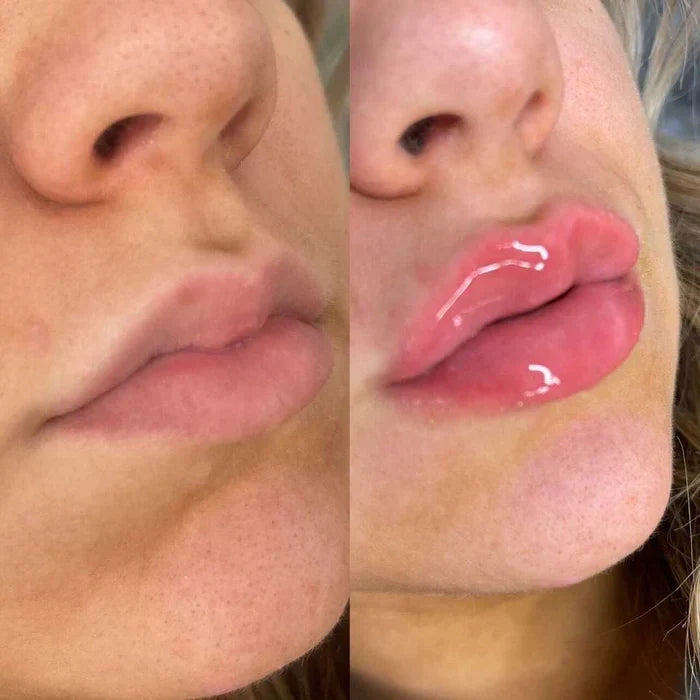 LumaGlow Instant Lip Plumper Serum for Fuller Lips Now