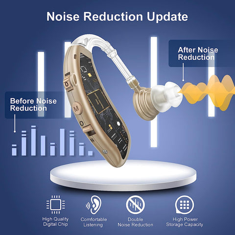 Niki | Behind-the-Ear Hearing Aid - Powerful Sound Enhancement