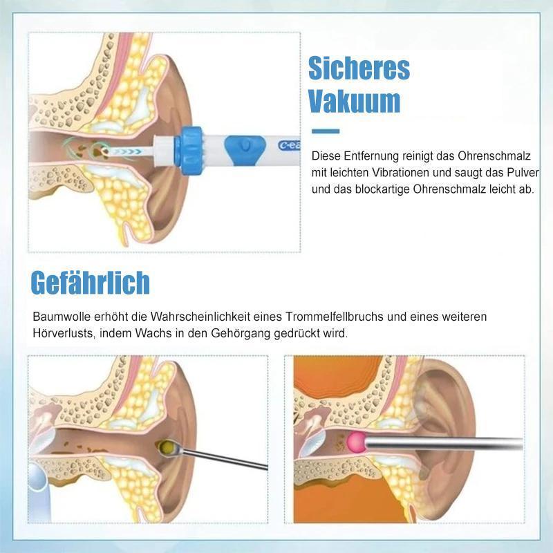 Niki | Ear Wax Remover Vacuum