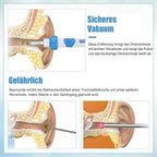 Niki | Ear Wax Remover Vacuum