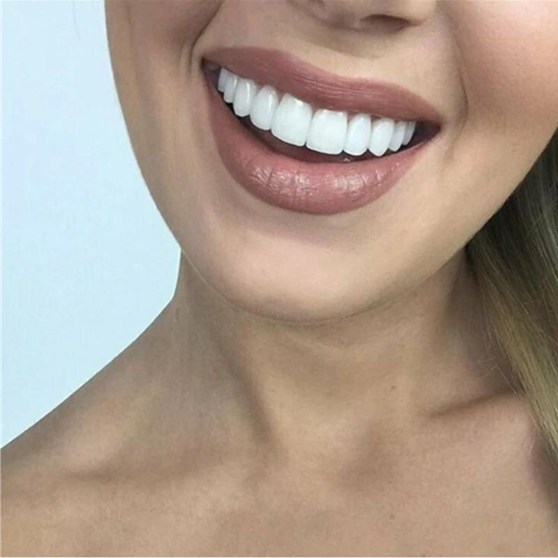Niki | Cosmetic Smile Veneers for Dental Confidence