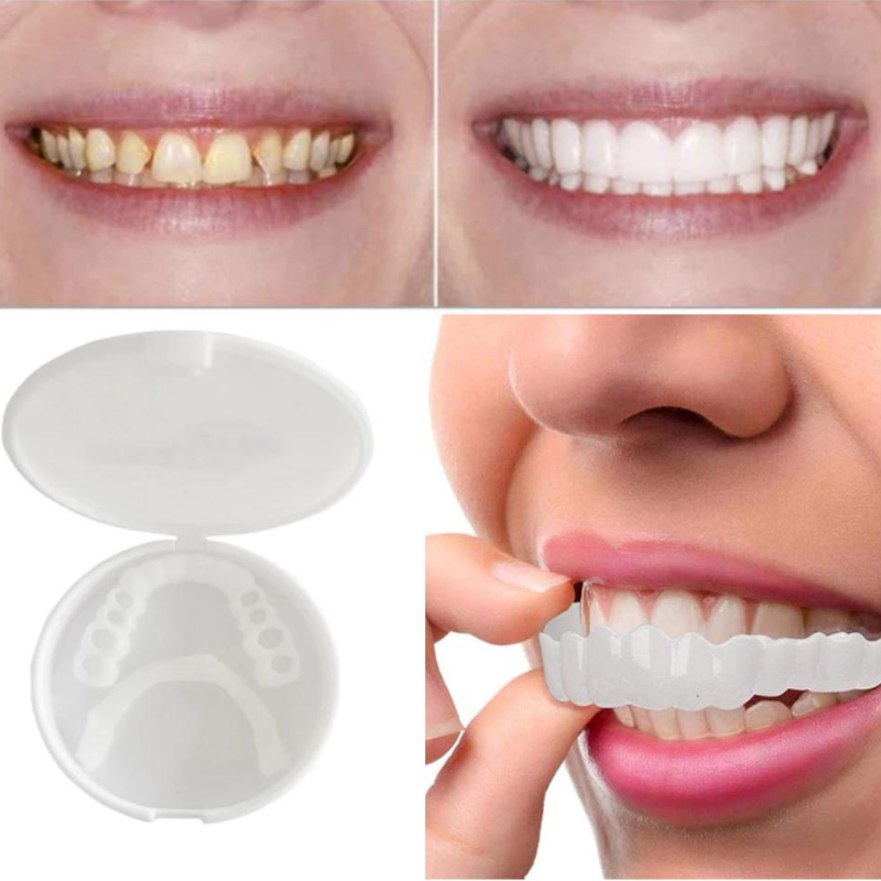 Niki | Cosmetic Smile Veneers for Dental Confidence