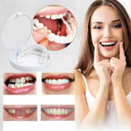 Niki | Cosmetic Smile Veneers for Dental Confidence