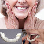 Niki | On Smile Veneers (Upper and Lower Jaw Included)