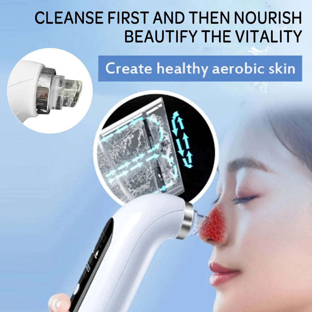 Niki | Facial Pore Cleanser Vacuum - Gentle Blackhead Extraction Tool