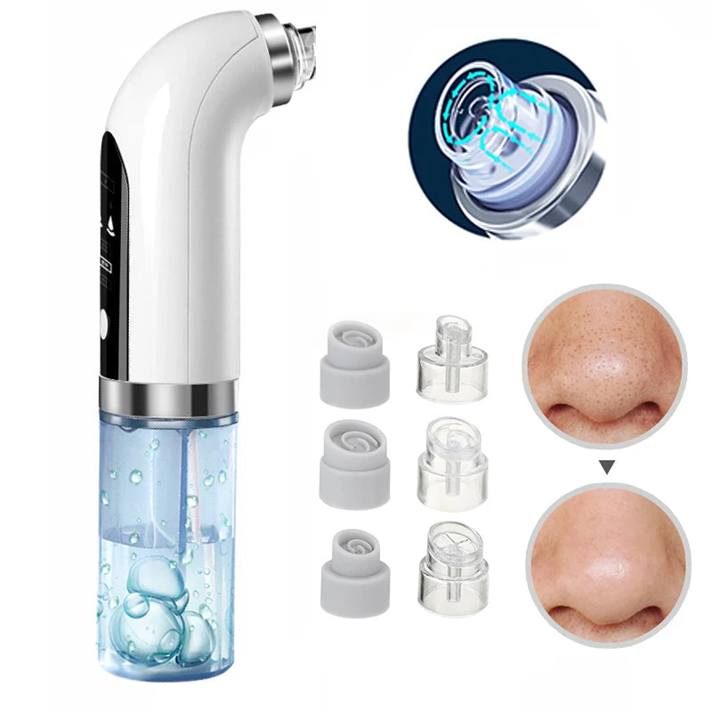Niki | Facial Pore Cleanser Vacuum - Gentle Blackhead Extraction Tool
